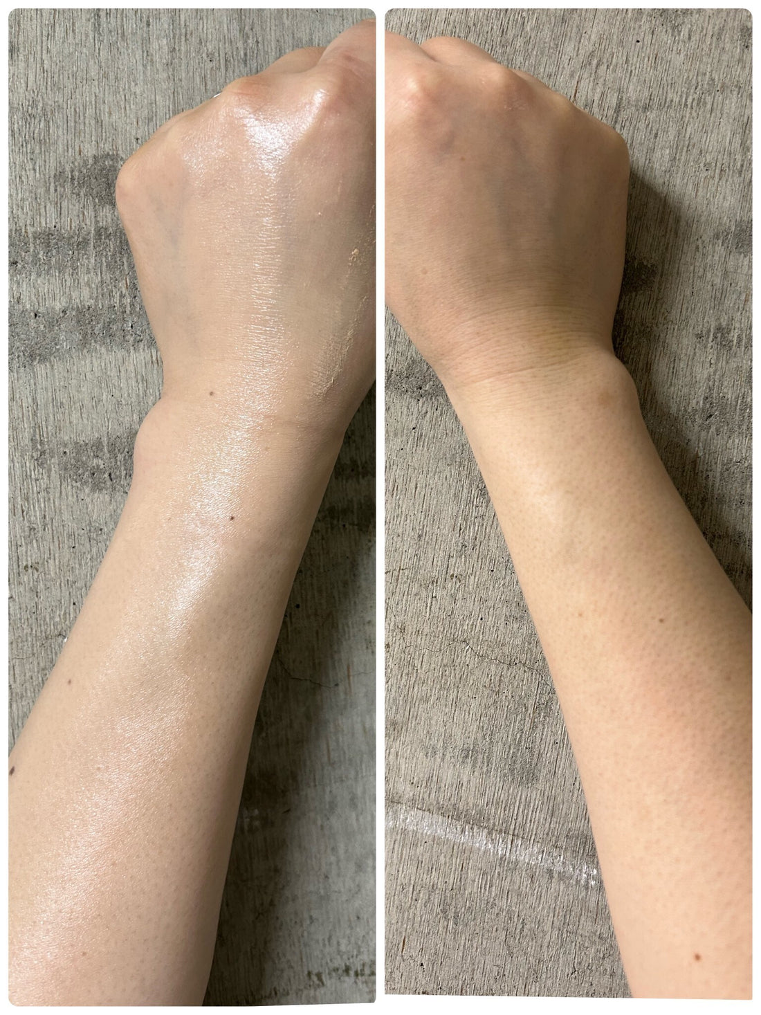 肌の露出が多くなる季節に